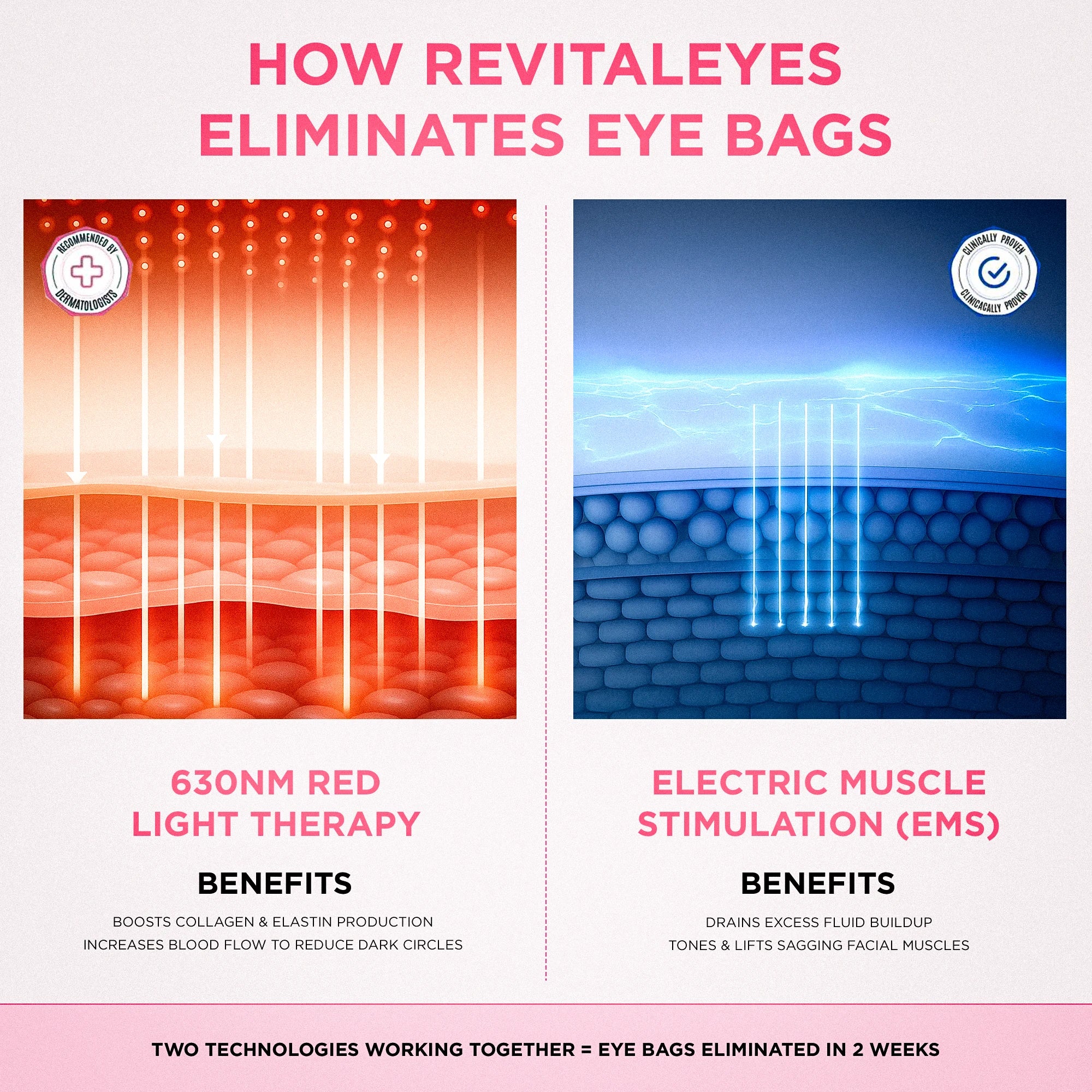 LumiEyes™ 2 - in - 1 Red Light Therapy + EMS To Erase Eye Bags - Luvée
