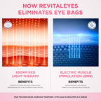 LumiEyes™ 2 - in - 1 Red Light Therapy + EMS To Erase Eye Bags - Luvée