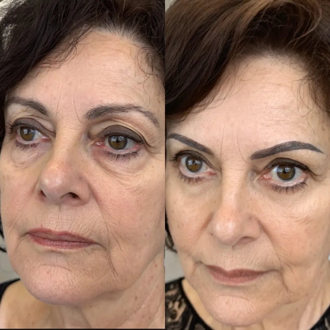 LumiEyes™ 2 - in - 1 Red Light Therapy + EMS To Erase Eye Bags - Luvée