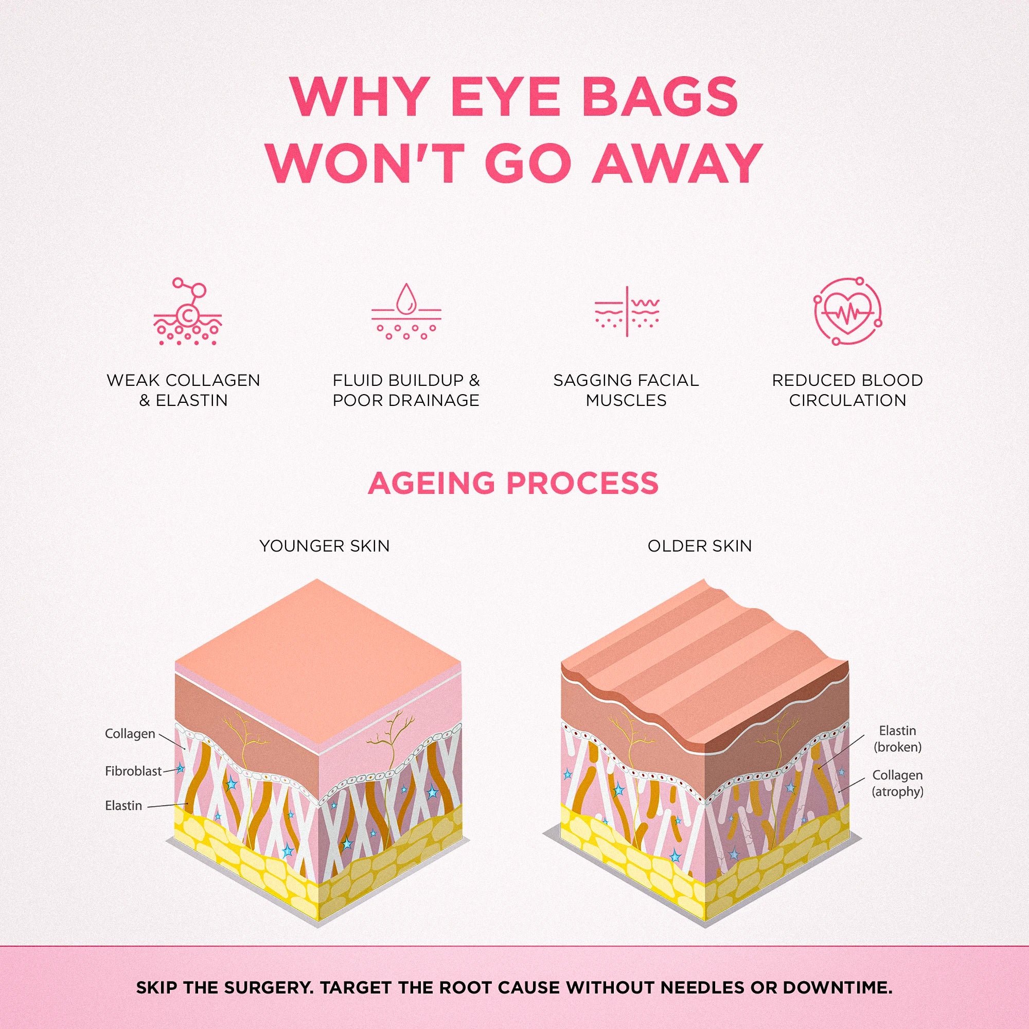LumiEyes™ 2 - in - 1 Red Light Therapy + EMS To Erase Eye Bags - Luvée